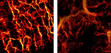 OCT uses an advanced optics system to non-invasively map out the network of tiny blood vessels beneath the outer layer of patients’ skin, potentially revealing tell-tale signs of disease OCT uses an advanced optics system to non-invasively map out the network of tiny blood vessels beneath the outer layer of patients’ skin, potentially revealing tell-tale signs of disease