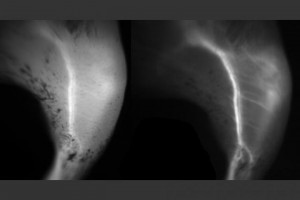 A comparison of blood vessels imaged with short-wave fluorescence imaging right and near-infrared fluorescence imaging left Both images rely on a fluorescent dye called ICG, but the vessels can be seen more clearly with short-wave fluorescence imaging A comparison of blood vessels imaged with short-wave fluorescence imaging right and near-infrared fluorescence imaging left Both images rely on a fluorescent dye called ICG, but the vessels can be seen more clearly with short-wave fluorescence imaging