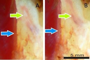 The blue arrow highlights a vertical structure A, which appears whiter after rotating the polarizers B The opposite occurs at the oblique structure green arrow indicating nerve tissue Image Credit Kenneth Chin, Academic Medical Center The blue arrow highlights a vertical structure A, which appears whiter after rotating the polarizers B The opposite occurs at the oblique structure green arrow indicating nerve tissue Image Credit Kenneth Chin, Academic Medical Center