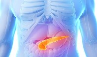 Light scattering spectroscopy detects pancreatic cancer Light scattering spectroscopy detects pancreatic cancer