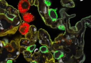 A sFLIM image of lung tissue labeled with three fluorophores shown in false colors The label locations are clearly visible against the otherwise strong autofluorescence background shown in gray A sFLIM image of lung tissue labeled with three fluorophores shown in false colors The label locations are clearly visible against the otherwise strong autofluorescence background shown in gray