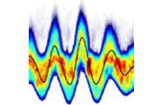 X-ray pulse X-ray pulse