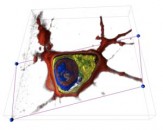 Marker-free nanoscopy is a transmission type holographic microscopy that employs two opposed high-numerical-aperture microscope objectives in its core