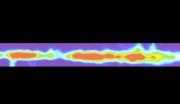 DNA Repair