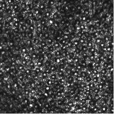 Image of a cone and rod mosaic in human retina using a Hi-Speed DM97 deformable mirror system. Image courtesy of Alfredo Dubra, Medical College of Wisconsin