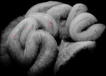 Researchers Use OCT Imaging to Uncover How the Fallopian Tube...