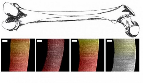Researchers used a new endoscopic OCT system to visualize variances in pig cartilage thickness The image shows a sketch of a femur and processed OCT images with thin regions shown in dark red and thicker regions more yellow and white Scale bar is 250 micr Researchers used a new endoscopic OCT system to visualize variances in pig cartilage thickness The image shows a sketch of a femur and processed OCT images with thin regions shown in dark red and thicker regions more yellow and white Scale bar is 250 micr