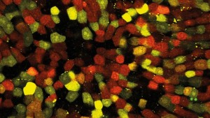 2Photon Microscopy 2Photon Microscopy