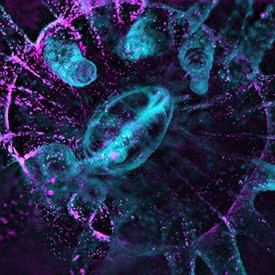 Darkfield imaging is used to reveal the non-autofluorescent coral tissue in the Northern Star coral Astrangia poculata, a species with no intrinsic fluorescence Non-fluorescent tissue cyan and algae magenta are combined in the image Credit Philippe Laissu Darkfield imaging is used to reveal the non-autofluorescent coral tissue in the Northern Star coral Astrangia poculata, a species with no intrinsic fluorescence Non-fluorescent tissue cyan and algae magenta are combined in the image Credit Philippe Laissu