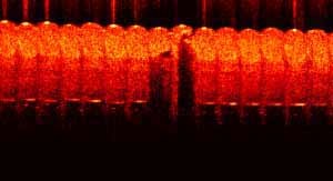 Laser material processing