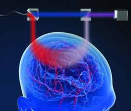 Brain research
