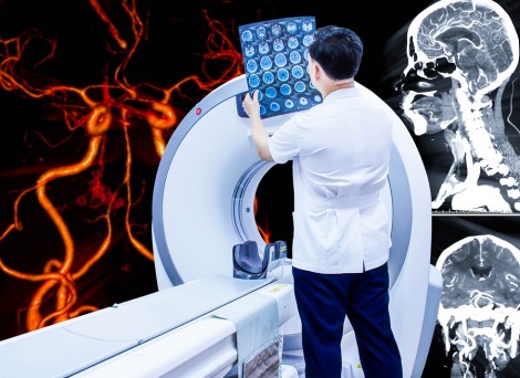brain imaging