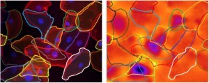 Force Imaging Technique Revolutionizes Understanding of Kidney Disease Force Imaging Technique Revolutionizes Understanding of Kidney Disease