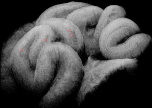Researchers use OCT imaging to uncover how the fallopian tube transports embryos