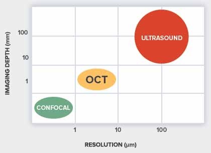 OCT vs Confocal