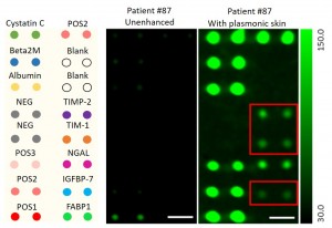 Plasmonic Patch Enhances Fluoresence in Biomedical Optics Plasmonic Patch Enhances Fluoresence in Biomedical Optics