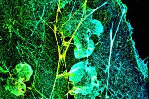 Typical dSTORM image of the actin cytoskeleton in a fixed COS-7 cell labeled by phalloidin-CF583R dSTORM was performed under standard conditions using a standard tris-based dSTORM imaging buffer containing 100 mM cysteamine and an oxygen scavenger Image c