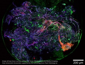 VALO lung tissue