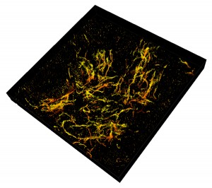 Purdue researchers have taken 3D single molecule super-resolution images of the amyloid plaques associated with Alzheimers disease in 30-micron thick sections of the mouses frontal cortex Purdue University imageFenil Patel Purdue researchers have taken 3D single molecule super-resolution images of the amyloid plaques associated with Alzheimers disease in 30-micron thick sections of the mouses frontal cortex Purdue University imageFenil Patel
