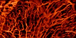 Optoacoustic imaging is particularly good at visualizing blood vessels Photograph ETH ZurichDaniel Razansky Optoacoustic imaging is particularly good at visualizing blood vessels Photograph ETH ZurichDaniel Razansky