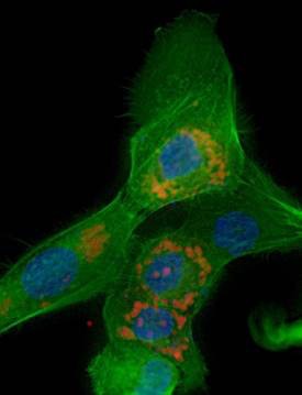 This is an image of the H-DAPPs  (red) inside breast cells.  Nucleus is blue and cell cytoskeleton is green. 