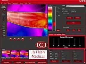 infrared camera in medical use infrared camera in medical use