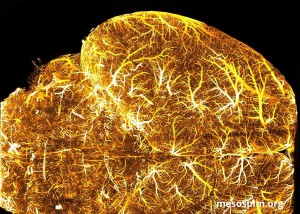 Brain imaging Brain imaging