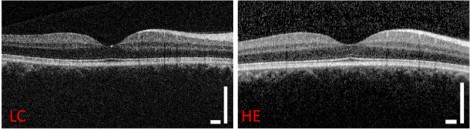 Retinal scanner