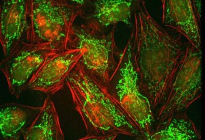Image of cells Courtesy of PCO Image of cells Courtesy of PCO