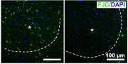 Brain slices of mice that received nano-photosynthetic therapy right have fewer damaged neurons, shown in green, than control mice left Credit Adapted from Nano Letters 2021, DOI 101021acsnanolett1c00719