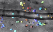 Captured by the lab of Jesse Schallek, assistant professor of ophthalmology and neuroscience, the image shows microscopic immune cells escaping a nearby blood vessel in response to inflammation The color overlay shows computer detection of single cells th