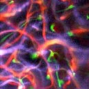 Brain vasculature in an anaesthetized mouse captured using Pysight Image Credit Pablo Blinder, Tel Aviv University