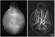 A new imaging method can capture images of vasculature deep in the brains of mice A conventional widefield fluorescence image of the mouse brain taken non-invasively in the visible light spectrum is shown on the left, while the non-invasive localization-b