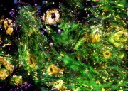 Label-free intraoperative nonlinear imaging of the tumor microenvironment provides real-time visualization of structural and molecular features, including extracellular vesicles that can be potential biomarkers of cancer aggressiveness Credit Biophotonics
