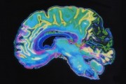 brain imaging