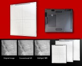 Canon Medical