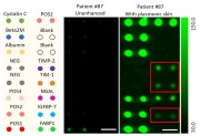 Plasmonic Patch Enhances Fluoresence in Biomedical Optics
