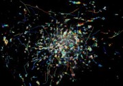 The rapid movements of Rab11 particles can be clearly imaged with the new instant TIRF-SIM microscope Credit Hari Shroff, National Institute of Biomedical Imaging and Bioengineering