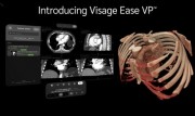 Visage
